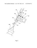 SYSTEM FOR HANDLING AN AUGMENTATION IMPLANT diagram and image