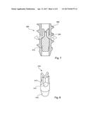 SYSTEM FOR HANDLING AN AUGMENTATION IMPLANT diagram and image