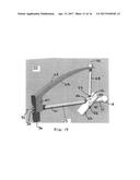 BONE FRACTURE  FIXATION DEVICE WITH TRANSVERSE SET SCREW AND AIMING GUIDE diagram and image