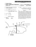 METHOD FOR CLOSURE AND ABLATION OF ATRIAL APPENDAGE diagram and image