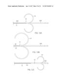 CATHETER WITH MEMBRANED SPINES FOR PULMONARY VEIN ISOLATION diagram and image