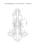 CATHETER WITH MEMBRANED SPINES FOR PULMONARY VEIN ISOLATION diagram and image