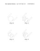 HIGH PERFORMANCE MATERIAL FOR ELECTRO-SURGICAL VAPORIZATION ELECTRODES diagram and image