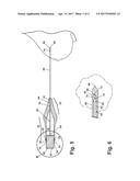 SELF-CONTAINED, SELF-PIERCING, SIDE-EXPELLING MARKING APPARATUS diagram and image