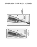 DENTAL SCREWDRIVER diagram and image