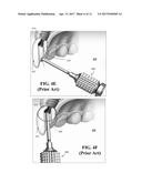 DENTAL SCREWDRIVER diagram and image