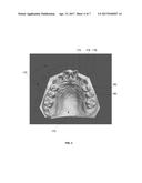 TOOTH MODELING SYSTEM diagram and image