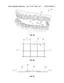 THREE-DIMENSIONAL PRINTED DENTAL APPLIANCES USING LATTICES diagram and image