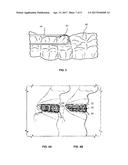 THREE-DIMENSIONAL PRINTED DENTAL APPLIANCES USING LATTICES diagram and image