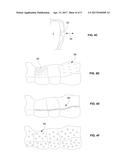 THREE-DIMENSIONAL PRINTED DENTAL APPLIANCES USING LATTICES diagram and image