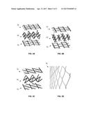 THREE-DIMENSIONAL PRINTED DENTAL APPLIANCES USING LATTICES diagram and image