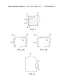 THREE-DIMENSIONAL PRINTED DENTAL APPLIANCES USING SUPPORT STRUCTURES diagram and image