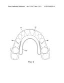 THREE-DIMENSIONAL PRINTED DENTAL APPLIANCES USING SUPPORT STRUCTURES diagram and image