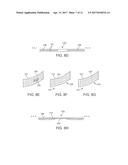 THREE-DIMENSIONAL PRINTED DENTAL APPLIANCES USING SUPPORT STRUCTURES diagram and image