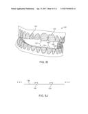 THREE-DIMENSIONAL PRINTED DENTAL APPLIANCES USING SUPPORT STRUCTURES diagram and image