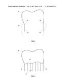 SYSTEMS AND METHODS FOR FABRICATING DENTAL APPLIANCES OR SHELLS diagram and image