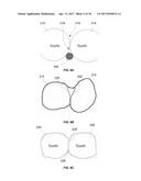 ORTHODONTIC PLANNING SYSTEMS diagram and image