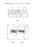 ORTHODONTIC PLANNING SYSTEMS diagram and image