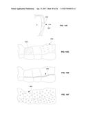 ORTHODONTIC PLANNING SYSTEMS diagram and image