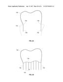 ORTHODONTIC PLANNING SYSTEMS diagram and image