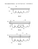 ORTHODONTIC PLANNING SYSTEMS diagram and image