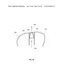 ORTHODONTIC PLANNING SYSTEMS diagram and image