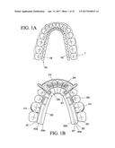 ORTHODONTIC ASSEMBLY diagram and image