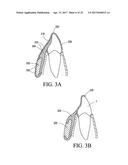 ORTHODONTIC ASSEMBLY diagram and image