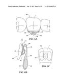 ORTHODONTIC ASSEMBLY diagram and image