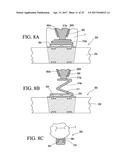 ORTHODONTIC ASSEMBLY diagram and image