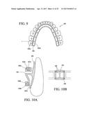 ORTHODONTIC ASSEMBLY diagram and image