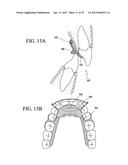 ORTHODONTIC ASSEMBLY diagram and image