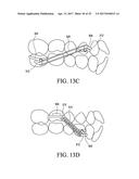 ORTHODONTIC ASSEMBLY diagram and image