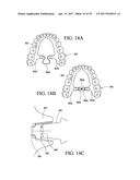 ORTHODONTIC ASSEMBLY diagram and image