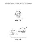 ORTHODONTIC ASSEMBLY diagram and image