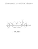 ORTHODONTIC ASSEMBLY diagram and image