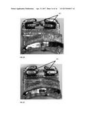 SELF-LIGATING BRACKET SYSTEM WITH PASSIVE OR INTERACTIVE CLIP diagram and image