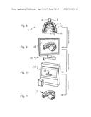 IMPRESSION TRAY, AND METHOD FOR CAPTURING STRUCTURES, ARRANGEMENTS OR     SHAPES, IN PARTICULAR IN THE MOUTH OR HUMAN BODY diagram and image