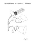 IMPRESSION TRAY, AND METHOD FOR CAPTURING STRUCTURES, ARRANGEMENTS OR     SHAPES, IN PARTICULAR IN THE MOUTH OR HUMAN BODY diagram and image