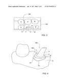 METHOD FOR MANIPULATING A DENTAL VIRTUAL MODEL, METHOD FOR CREATING     PHYSICAL ENTITIES BASED ON A DENTAL VIRTUAL MODEL THUS MANIPULATED, AND     DENTAL MODELS THUS CREATED diagram and image