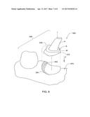 METHOD FOR MANIPULATING A DENTAL VIRTUAL MODEL, METHOD FOR CREATING     PHYSICAL ENTITIES BASED ON A DENTAL VIRTUAL MODEL THUS MANIPULATED, AND     DENTAL MODELS THUS CREATED diagram and image