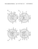 MEDICAL DEVICE HAVING REMOVABLE DEPLOYMENT DEVICE AND AFFIXATION ELEMENT diagram and image