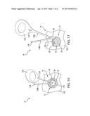 MEDICAL DEVICE HAVING REMOVABLE DEPLOYMENT DEVICE AND AFFIXATION ELEMENT diagram and image