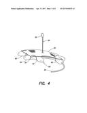 SOFT TISSUE REPAIR PROSTHESIS, EXPANDABLE DEVICE, AND METHOD OF SOFT     TISSUE REPAIR diagram and image