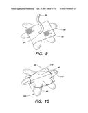 SOFT TISSUE REPAIR PROSTHESIS, EXPANDABLE DEVICE, AND METHOD OF SOFT     TISSUE REPAIR diagram and image