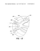 SOFT TISSUE REPAIR PROSTHESIS, EXPANDABLE DEVICE, AND METHOD OF SOFT     TISSUE REPAIR diagram and image