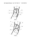 TILTABLE IMPLANTABLE MEDICAL DEVICE diagram and image