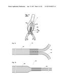 STENT ASSEMBLY FOR THORACOABDOMINAL BIFURCATED ANEURYSM REPAIR diagram and image