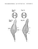 STENT ASSEMBLY FOR THORACOABDOMINAL BIFURCATED ANEURYSM REPAIR diagram and image