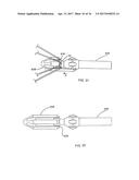 Methods of Self-Aligning Stent Grafts diagram and image